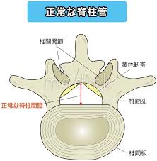 脊柱管狭窄症とは？？　京都市北区北大路　北大路東洋鍼灸整骨院