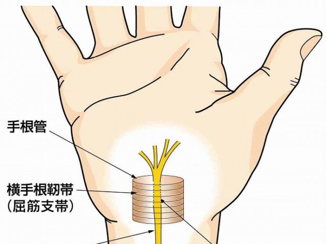 手のしびれ　指先の痺れ　京都市北区/左京区　北大路東洋鍼灸整骨院