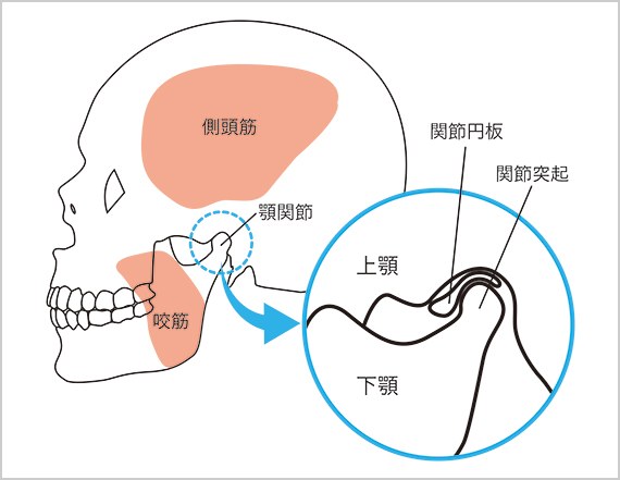 顎関節症　顎の痛み　京都市北区/左京区　北大路東洋鍼灸整骨院