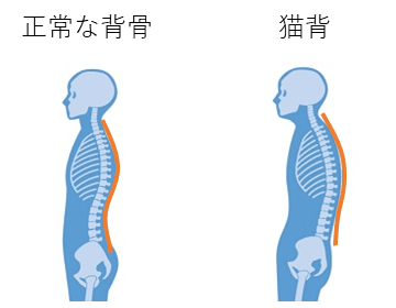 背中の痛み　背部痛　京都市北区/左京区　北大路東洋鍼灸整骨院