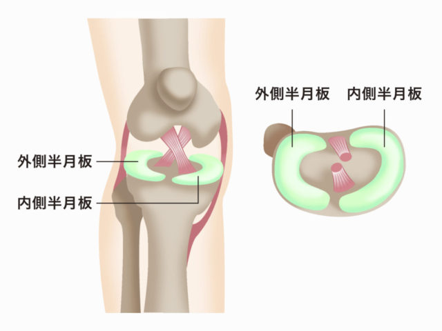 膝の痛み　半月板　膝を曲げると痛い　京都市北区/左京区　北大路東洋鍼灸整骨院