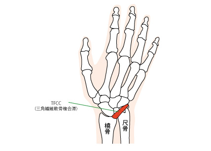 手首の痛み　TFCC損傷　京都市北区/左京区　北大路東洋鍼灸整骨院