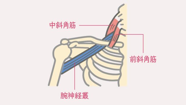 胸郭出口症候群　腕の痺れ　首の痛み　京都市北区/左京区　北大路東洋鍼灸整骨院