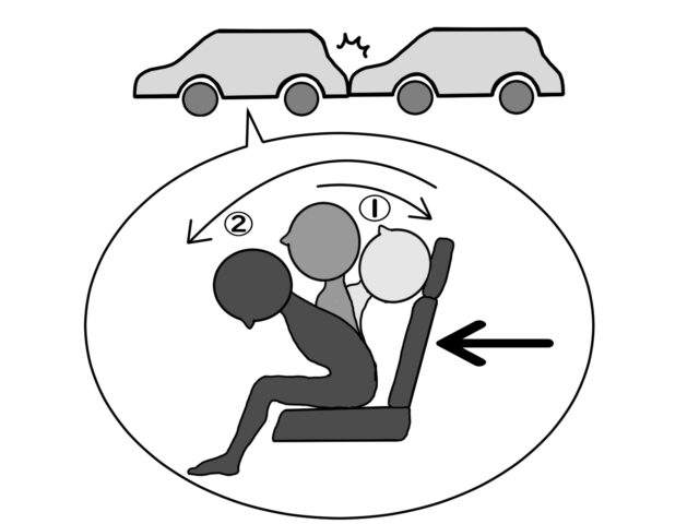 交通事故とは？　京都市　北区/上京区　北大路東洋鍼灸整骨院