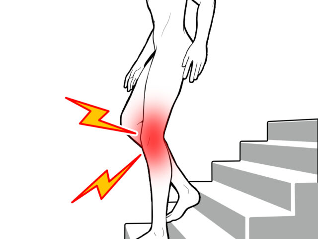 シンスプリント　スネの痛み　スポーツ外傷　京都市北区/左京区　北大路東洋鍼灸整骨院